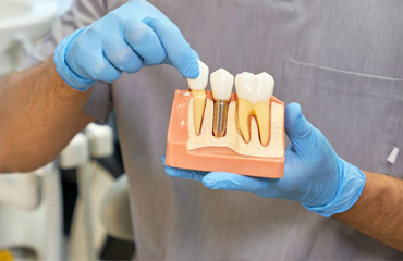 Rayos X Dentales Digitales en Puebla