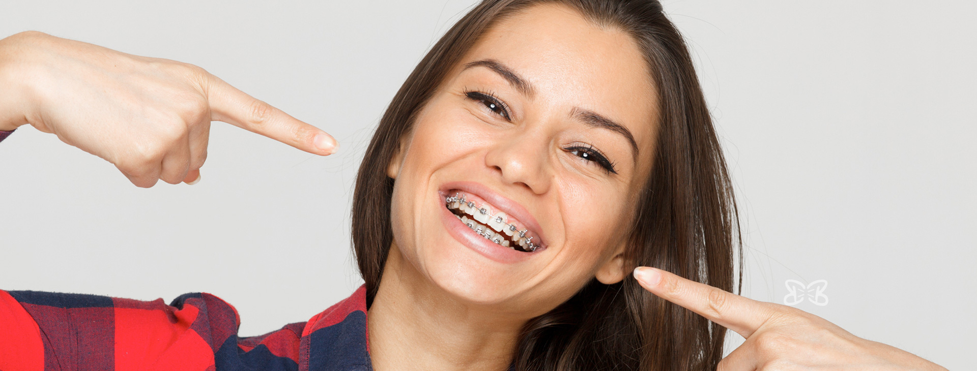 Aplicación de Brackets Estéticos Autoligado Baja Fricción en Puebla